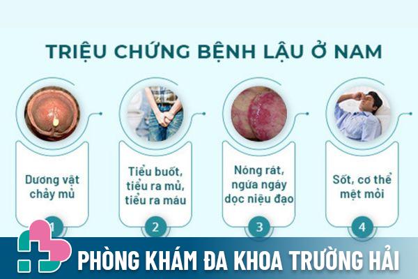 Lỗ sáo chảy mủ là triệu chứng điển hình của bệnh lậu