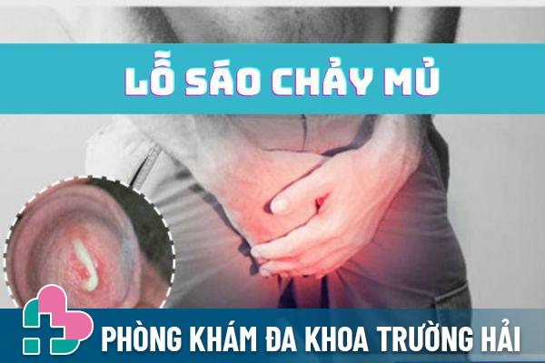 Lỗ sáo chảy mủ – Dấu hiệu bệnh lý không nên xem thường