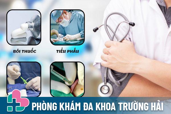 Phương pháp điều trị mụn cóc dương vật hiệu quả, an toàn