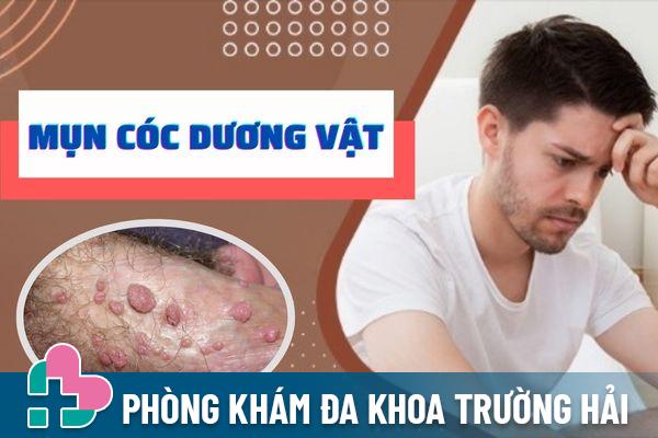 Nhận biết mụn cóc dương vật – Cách điều trị hiệu quả