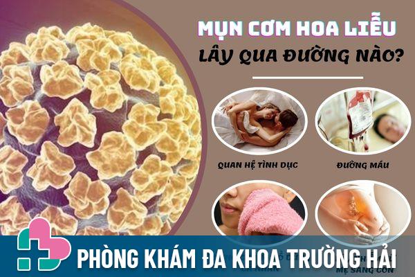 Mụn cơm hoa liễu lây truyền qua nhiều con đường khác nhau