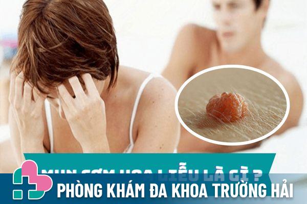 Mụn cơm hoa liễu là gì – Nguyên nhân và cách điều trị hiệu quả