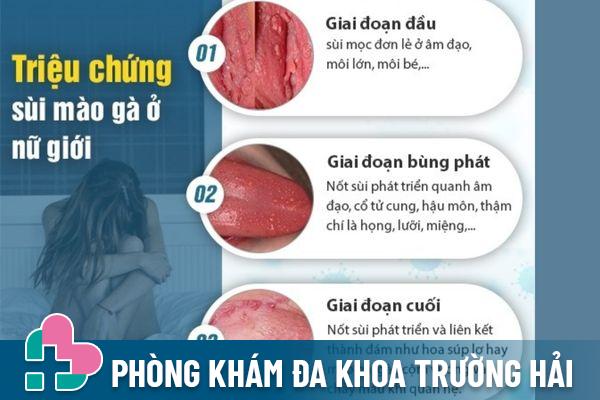 Nổi mụn âm đạo là triệu chứng điển hình của bệnh sùi mào gà