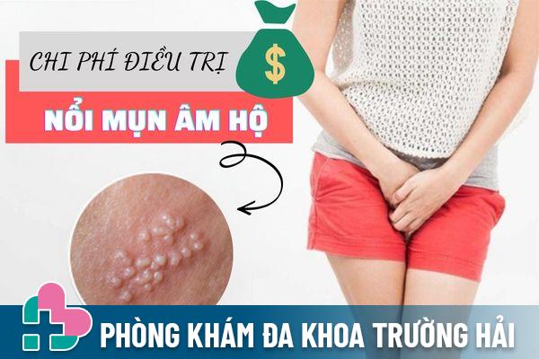 Chi phí điều trị nổi mụn âm hộ hết bao nhiêu tiền?