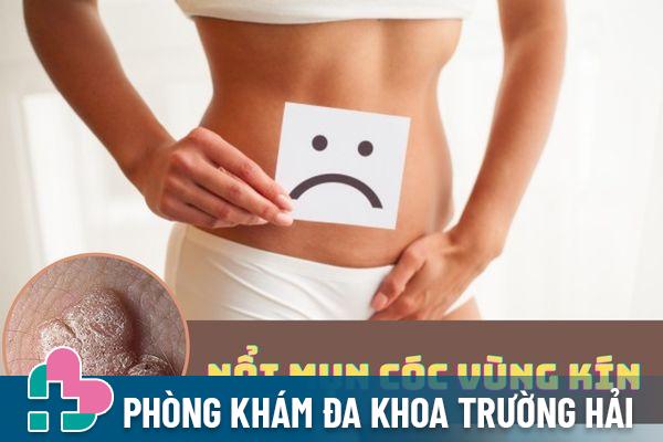 Nổi mụn cóc vùng kín – Triệu chứng bệnh lý không nên xem thường