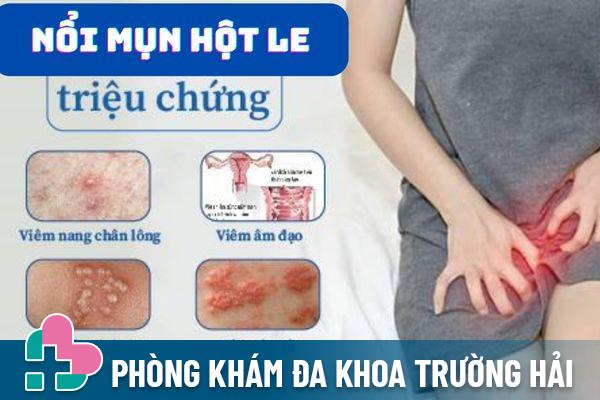 Nổi mụn hột le là dấu hiệu cảnh báo nhiều bệnh lý nguy hiểm