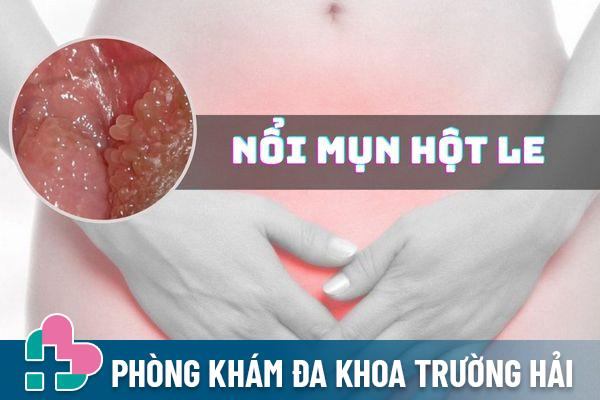 [Giải đáp] Nổi mụn hột le do đâu và cách điều trị hiệu quả