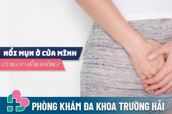 Nổi mụn ở cửa mình là bị bệnh gì? Có nguy hiểm không?