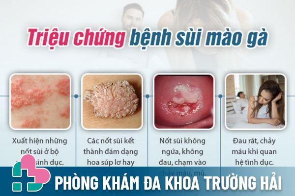 Triệu chứng nhận biết bệnh sùi mào gà