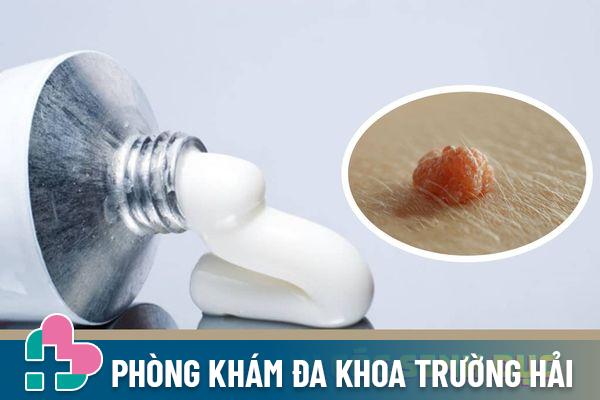 Các loại thuốc bôi mụn cóc sinh dục hiệu quả và an toàn