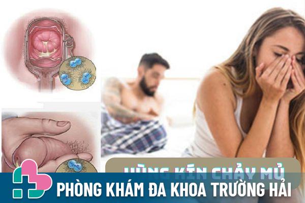 Vùng kín chảy mủ – Cảnh báo bệnh lý không nên xem thường