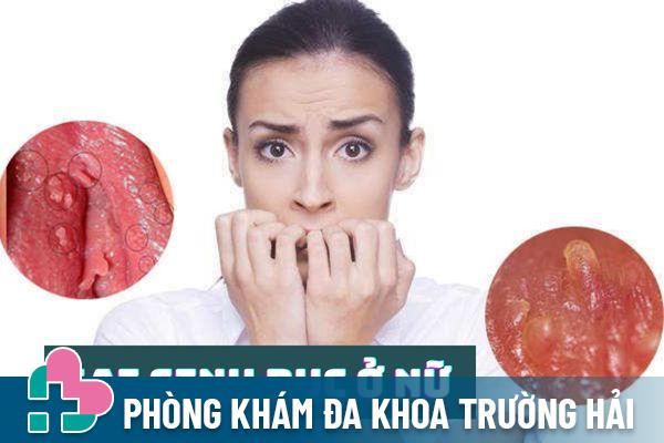 Gai sinh dục ở nữ: Nguyên nhân, triệu chứng và cách điều trị