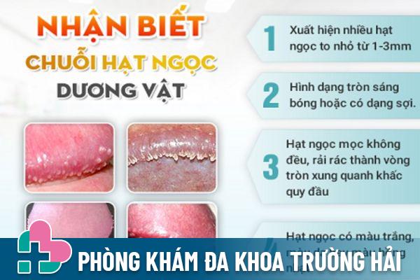 Dấu hiệu nhận biết hạt ngọc dương vật ở nam giới