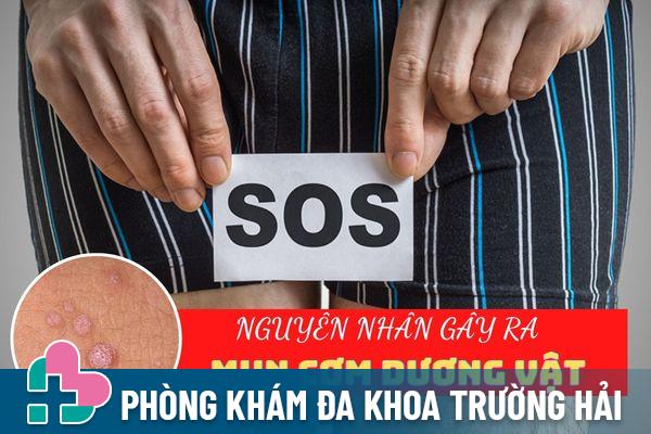 Lý giải nguyên nhân gây ra tình trạng mụn cơm dương vật