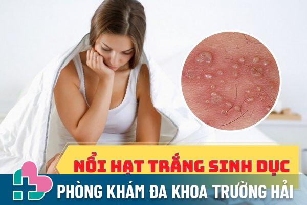 Nổi hạt trắng sinh dục là bị bệnh gì?