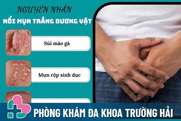 Nổi mụn trắng ở dương vật cảnh báo nhiều bệnh xã hội nguy hiểm