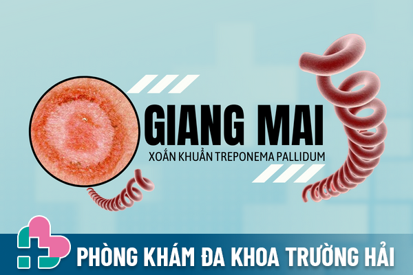 Giang mai – Không chỉ dai dẳng mà còn rất nguy hiểm.