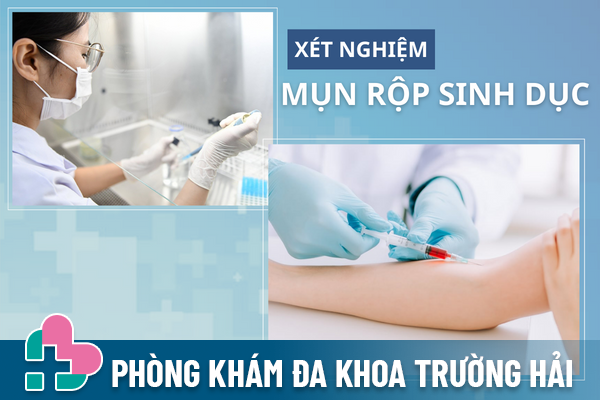 Mun-rop-sinh-duc-tuong-mun-mu-don-gian-nhung-lai-cuc-nguy-hiem-3