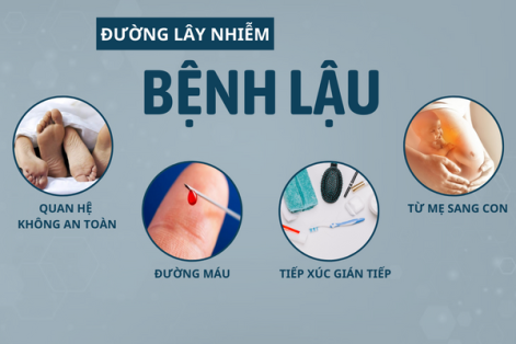 Bệnh lậu cách chữa như thế nào?