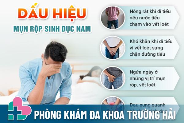 Dấu hiệu nhận biết bệnh mụn rộp nam