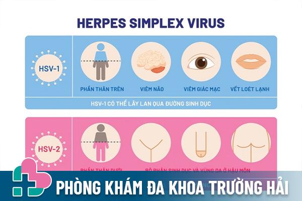 Herpes Simplex Virus có 2 type gây bệnh