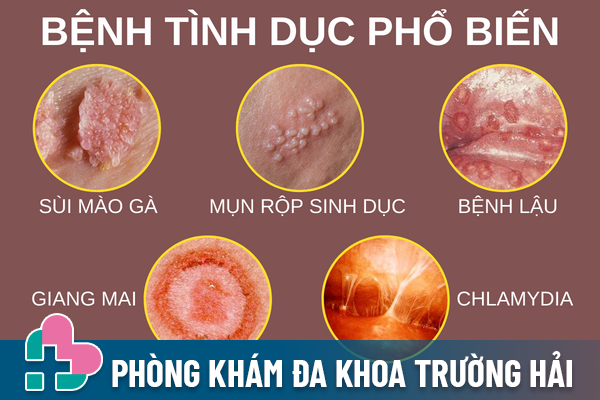 Benh-vien-chua-benh-tinh-duc-uy-tin-tai-tp-da-nang-1