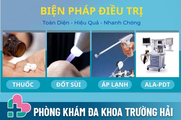 Cách khắc phục bệnh sùi mào gà ở nam hiệu quả