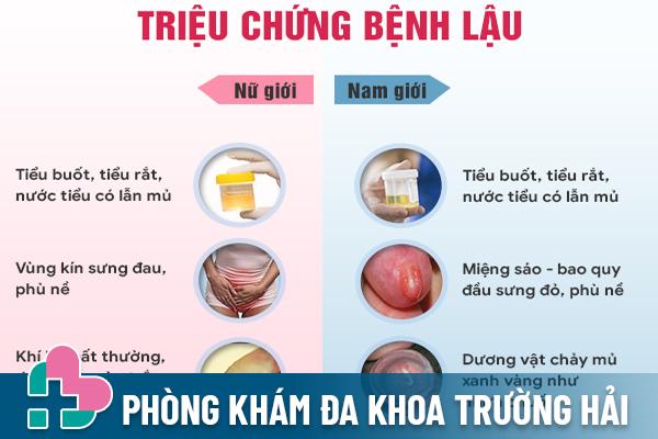 Triệu chứng bệnh lậu cần nhận biết