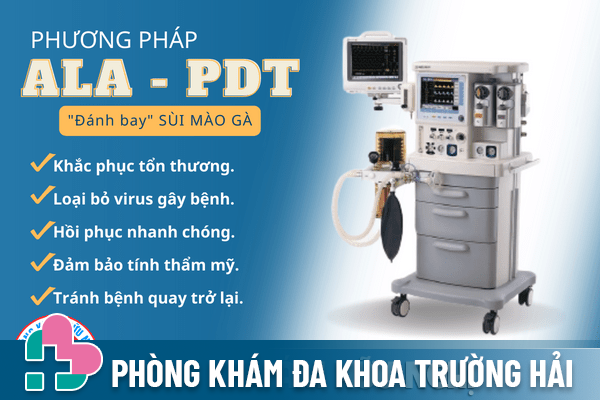 Phuong-phap-ala-pdt-buoc-tien-hoan-hao-trong-dieu-tri-sui-mao-ga-1