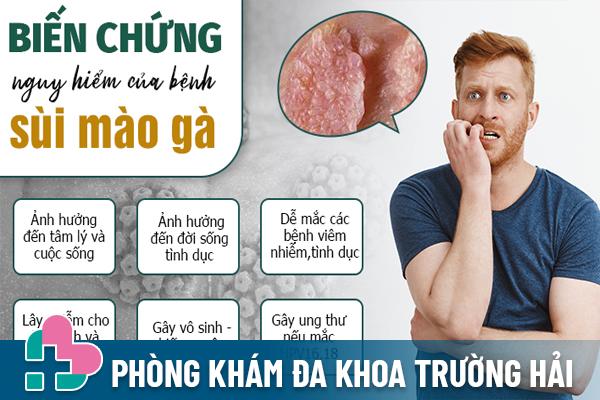 Tác hại sùi mào gà ở lỗ sáo gây ra