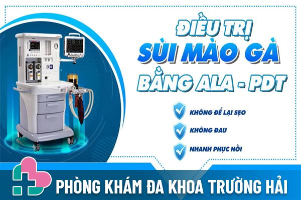 Điều trị sùi mào gà hiệu quả tại Phòng Khám Trường Hải ở Hải Dương