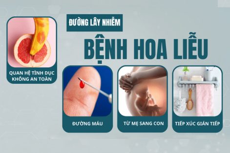 Tổng hợp những thông tin về căn bệnh hoa liễu