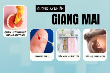 Giang mai lây qua đường nào?