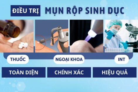 Điều trị mụn rộp sinh dục như thế nào hiệu quả?