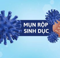 Nhung-dieu-can-biet-ve-mun-rop-am-dao