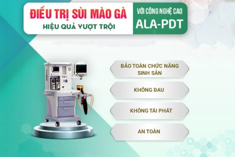 Phương pháp ALA-PDT hỗ trợ điều trị sùi mào gà