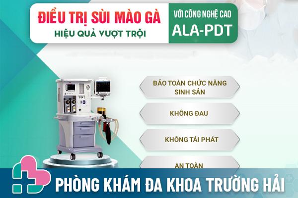 Phuong-phap-ala-ho-tro-dieu-tri-sui-mao-ga