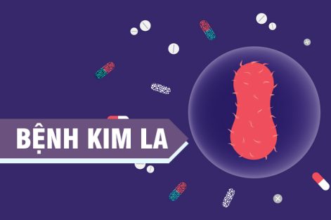 Bệnh kim la là gì? Dấu hiệu nhận biết như thế nào? 