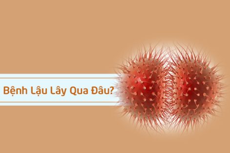 Bệnh lậu lây qua đâu? Triệu chứng nhận biết bệnh