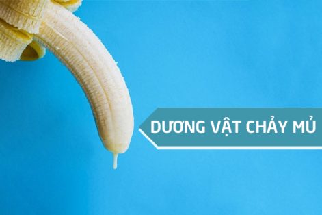 Dương vật chảy mủ là bị bệnh gì? Có sao không?