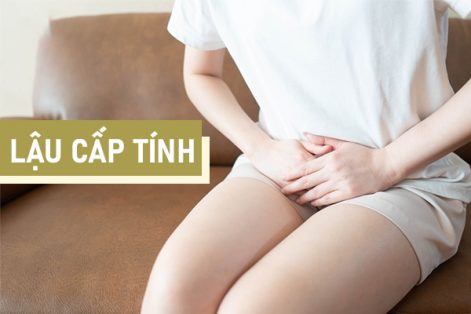 Lậu cấp tính: Nguyên nhân, dấu hiệu và cách chữa trị hiệu quả