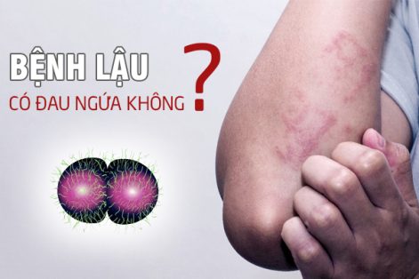 Mắc bệnh lậu có đau ngứa không?