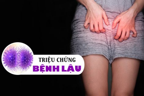 Dấu hiệu, triệu chứng bệnh lậu thường gặp nhất 