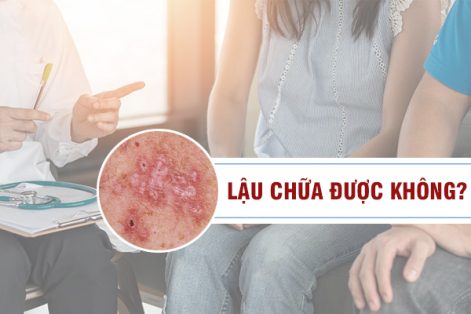 Bệnh lậu chữa được không? Phương pháp trị bệnh hiệu quả 