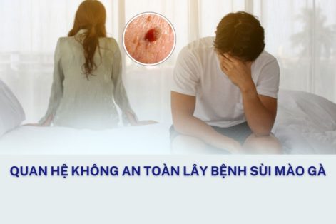 Bệnh sùi mào gà có triệu chứng gì điều trị thế nào?