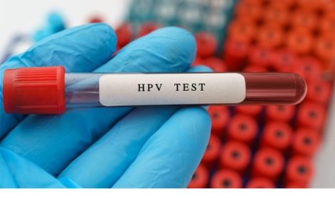 Xét nghiệm sùi mào gà nhanh, chính xác tại Đa khoa Hải Phòng