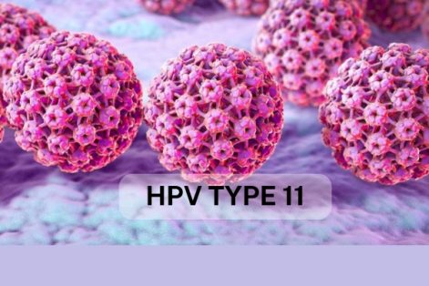 HPV type 11 có nguy hiểm không?