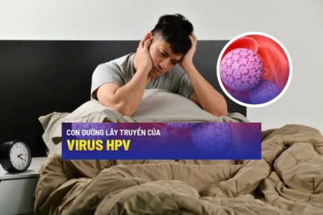 Bệnh hpv ở nam giới nguyên nhân dấu hiệu và cách chữa