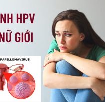 Benh-hpv-o-nu-gioi