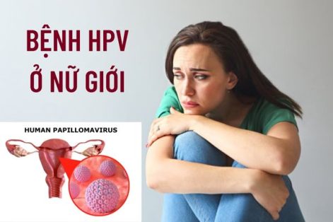 Dấu hiệu mắc bệnh HPV ở nữ giới